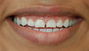 Spacing thumbnail