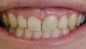 Beautiful Smile thumbnail