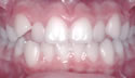 Orthodontics thumbnail