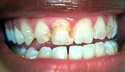 Worn Out thumbnail